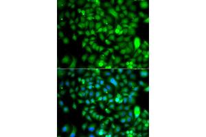 Immunofluorescence analysis of A549 cell using CSRP2BP antibody.