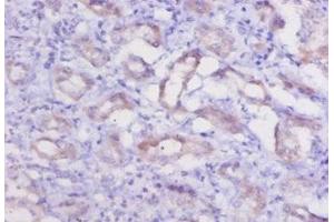 Immunohistochemistry of paraffin-embedded human kidney tissue using ABIN7178829 at dilution of 1:20 (Cathepsin K Antikörper  (AA 115-329))