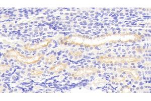 Immunohistochemistry (IHC) image for anti-Matrix Metallopeptidase 3 (Stromelysin 1, Progelatinase) (MMP3) (AA 18-477) antibody (ABIN7431005)