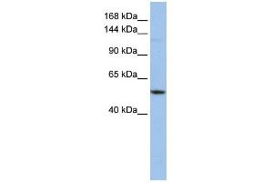 WB Suggested Anti-UBE4A Antibody Titration:  0.