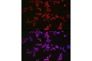 Immunofluorescence analysis of F9 cells using TET2 Rabbit pAb (ABIN7270780) at dilution of 1:100 (40x lens). (TET2 Antikörper)