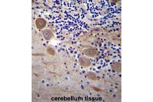 Immunohistochemistry (IHC) image for anti-Signal Sequence Receptor, beta (Translocon-Associated Protein Beta) (SSR2) antibody (ABIN2997190) (SSR2 Antikörper)