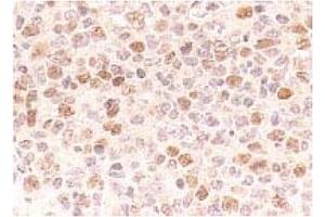 Immunohistochemistry (IHC) image for anti-Cell Division Cycle 7 (CDC7) antibody (ABIN487481) (CDC7 Antikörper)