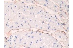 Detection of FBN1 in Mouse Heart Tissue using Polyclonal Antibody to Fibrillin 1 (FBN1) (Fibrillin 1 Antikörper  (AA 1703-1889))