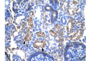 WB Suggested Anti-SERPINA1 Antibody Titration: 4.