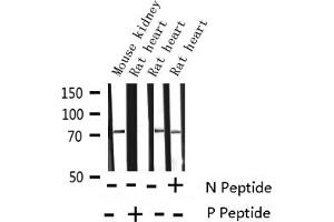 Western blot analysis of Phospho-Tau (Thr231) expression in various lysates (MAPT Antikörper  (pThr231))