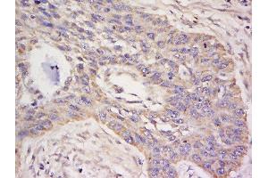 Immunohistochemistry (Paraffin-embedded Sections) (IHC (p)) image for anti-Leukocyte Immunoglobulin-Like Receptor, Subfamily B (With TM and ITIM Domains), Member 5 (LILRB5) (AA 151-250) antibody (ABIN748688)