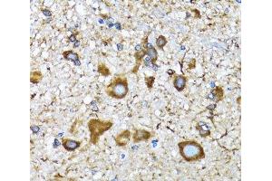Immunohistochemistry of paraffin-embedded Mouse spinal cord using MAP1LC3A Polyclonal Antibody at dilution of 1:100 (40x lens). (MAP1LC3A Antikörper)