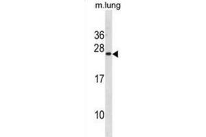Western Blotting (WB) image for anti-Iron-sulfur cluster assembly enzyme ISCU, mitochondrial (ISCU) antibody (ABIN3001333) (ISCU Antikörper)
