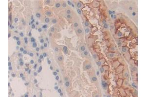 DAB staining on IHC-P; Samples: Human Kidney Tissue (KIR2DS2 Antikörper  (AA 22-304))