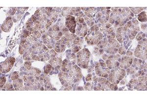 ABIN6273226 at 1/100 staining Human pancreas cancer tissue by IHC-P. (DIO1 Antikörper  (C-Term))