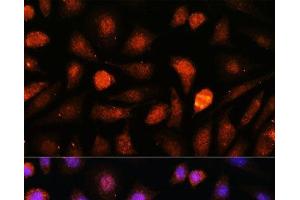 Immunofluorescence analysis of L-929 cells using CDK5RAP1 Polyclonal Antibody at dilution of 1:100. (CDK5RAP1 Antikörper)