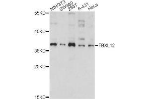 Western blot analysis of extracts of various cell lines, using FBXL12 antibody. (FBXL12 Antikörper)