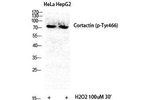 Western Blot (WB) analysis of specific cells using Phospho-Cortactin (Y466) Polyclonal Antibody. (Cortactin Antikörper  (pTyr466))