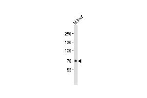 Anti-ALB Antibody (C-term)at 1:1000 dilution + mouse liver lysates Lysates/proteins at 20 μg per lane. (Albumin Antikörper  (C-Term))