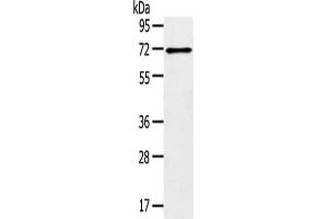 Gel: 8 % SDS-PAGE,Lysate: 40 μg,Primary antibody: ABIN7192909(TRIM47 Antibody) at dilution 1/300 dilution,Secondary antibody: Goat anti rabbit IgG at 1/8000 dilution,Exposure time: 1 minute (TRIM47 Antikörper)