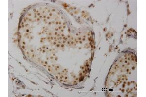 Immunostaining (ISt) image for anti-Nuclear Factor of Activated T-Cells, Cytoplasmic, Calcineurin-Dependent 3 (NFATC3) (AA 70-149) antibody (ABIN518312)