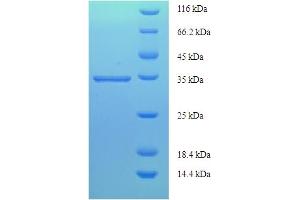 SDS-PAGE (SDS) image for Prostaglandin D2 Synthase (PTGDS) (AA 23-190) protein (His-SUMO Tag) (ABIN5710175) (PTGDS Protein (AA 23-190) (His-SUMO Tag))