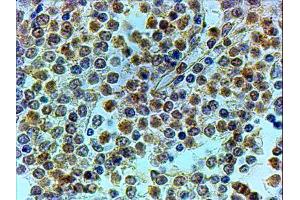 ABIN2560562 (4µg/ml) staining of paraffin embedded Human Spleen. (LRRFIP1 Antikörper  (C-Term))