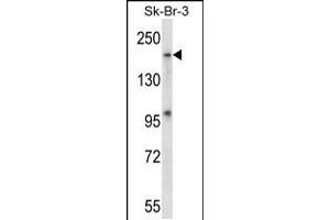 Western blot analysis in SK-BR-3 cell line lysates (35ug/lane). (MAP4K4 Antikörper  (AA 506-534))