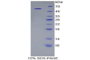 SDS-PAGE (SDS) image for Kallikrein 8 (KLK8) (AA 34-260) protein (His tag,GST tag) (ABIN1879806) (Kallikrein 8 Protein (KLK8) (AA 34-260) (His tag,GST tag))
