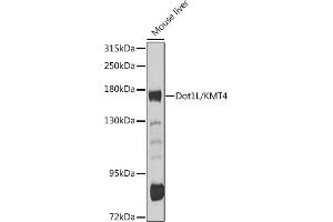 Western blot analysis of extracts of mouse liver, using Dot1L/KMT4 antibody (ABIN6130310, ABIN6139773, ABIN6139777 and ABIN6215149) at 1:1000 dilution. (DOT1L Antikörper  (AA 1-250))