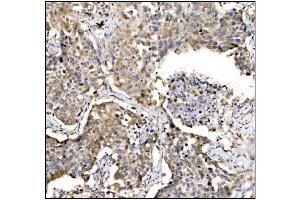 IHC analysis of Caspase-9/CASP9 using anti-Caspase-9/CASP9 antibody (ABIN7600340). (Caspase 9 Antikörper  (AA 18-416))