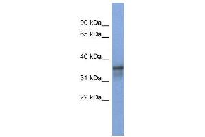 WB Suggested Anti-RBM9  Antibody Titration: 0. (RBM9 Antikörper  (Middle Region))