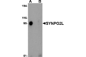 Western Blotting (WB) image for anti-Synaptopodin 2-Like (SYNPO2L) (N-Term) antibody (ABIN1031594)