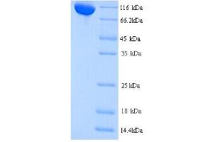 SDS-PAGE (SDS) image for CCCTC-Binding Factor (Zinc Finger Protein)-Like (CTCFL) (AA 1-636), (full length) protein (His tag) (ABIN5713384)
