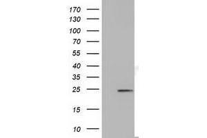 Western Blotting (WB) image for anti-MOB Kinase Activator 3B (MOB3B) antibody (ABIN1499539) (MOBKL2B Antikörper)
