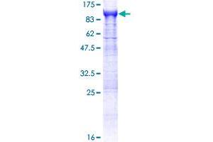 APEH Protein (AA 1-732) (GST tag)