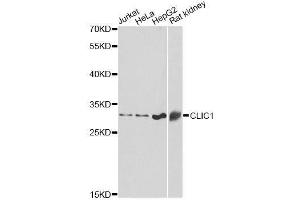 Western blot analysis of extracts of various cell lines, using CLIC1 antibody. (CLIC1 Antikörper  (AA 42-241))
