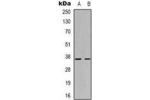 Western blot analysis of GHITM expression in Hela (A), Ramos (B) whole cell lysates. (GHITM Antikörper)