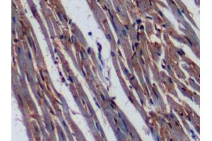 Immunohistochemistry (IHC) image for anti-CD36 (CD36) (AA 91-311) antibody (ABIN1859048)