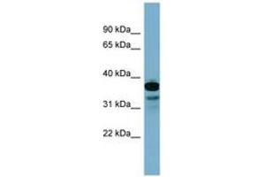 Image no. 1 for anti-Adenylate Kinase 9 (AK9) (C-Term) antibody (ABIN6744471) (Adenylate Kinase 9 Antikörper  (C-Term))