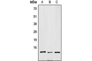 Western blot analysis of SNRPD3 expression in Jurkat (A), mouse brain (B), H9C2 (C) whole cell lysates. (SNRPD3 Antikörper  (Center))