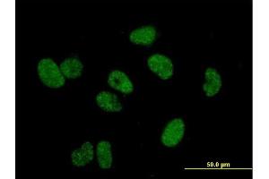 Immunofluorescence of purified MaxPab antibody to TERF1 on HeLa cell. (TRF1 Antikörper  (AA 1-439))