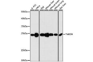 Western blot analysis of extracts of various cell lines, using TMED9 antibody. (TMED9 Antikörper  (AA 1-224))
