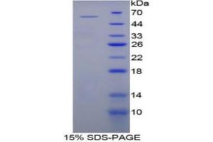 SDS-PAGE analysis of Mouse bACE2 Protein. (BACE2 Protein)