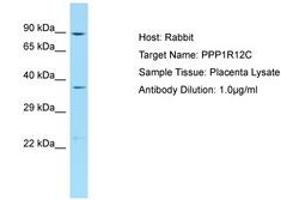 Image no. 1 for anti-Protein Phosphatase 1, Regulatory Subunit 12C (PPP1R12C) (AA 571-620) antibody (ABIN6750225) (PPP1R12C Antikörper  (AA 571-620))