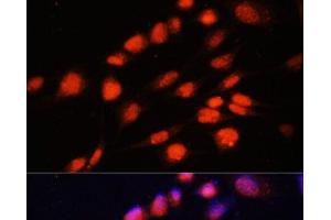 Immunofluorescence analysis of NIH-3T3 cells using ZNF416 Polyclonal Antibody at dilution of 1:100. (ZNF416 Antikörper)