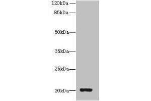 Western blot All lanes: ZBTB8OS antibody at 8 μg/mL + HL60 whole cell lysate Secondary Goat polyclonal to rabbit IgG at 1/10000 dilution Predicted band size: 20, 16 kDa Observed band size: 20 kDa (ZBTB8OS Antikörper  (AA 2-136))