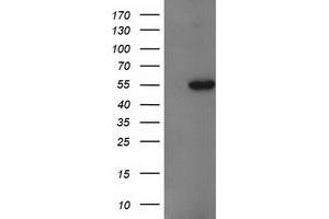 Western Blotting (WB) image for anti-Glucosidase, Beta, Acid 3 (Cytosolic) (GBA3) (AA 1-150), (AA 370-469) antibody (ABIN1490584) (GBA3 Antikörper  (AA 1-150, AA 370-469))