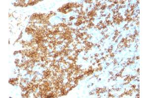 Formalin-fixed, paraffin-embedded human Tonsil stained with CD45RB Rabbit Recombinant Monoclonal Antibody (PTPRC/1783R). (Rekombinanter CD45 Antikörper)