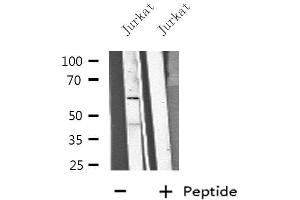 Western blot analysis of extracts from Jurkat cells, using CP1B1 antibody. (CYP1B1 Antikörper  (Internal Region))
