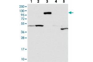 Western blot analysis of Lane 1: RT-4, Lane 2: U-251 MG, Lane 3: Human Plasma, Lane 4: Liver, Lane 5: Tonsil with CNTN5 polyclonal antibody  at 1:250-1:500 dilution. (Contactin 5 Antikörper)