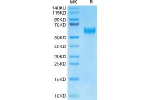 SDS-PAGE (SDS) image for Interleukin 18 Receptor Accessory Protein (IL18RAP) protein (His tag) (ABIN7274972)