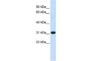 WB Suggested Anti-HOXC8 Antibody Titration: 1 ug/ml Positive Control: Fetal Muscle cell lysate (HOXC8 Antikörper  (N-Term))