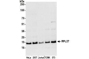anti-Ribosomal Protein L27 (RPL27) (AA 25-75) antibody